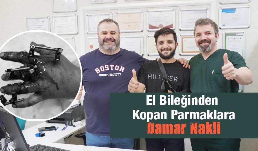 Bilekten, kopan parmaklara damar nakli Metrolife’de yapıldı!