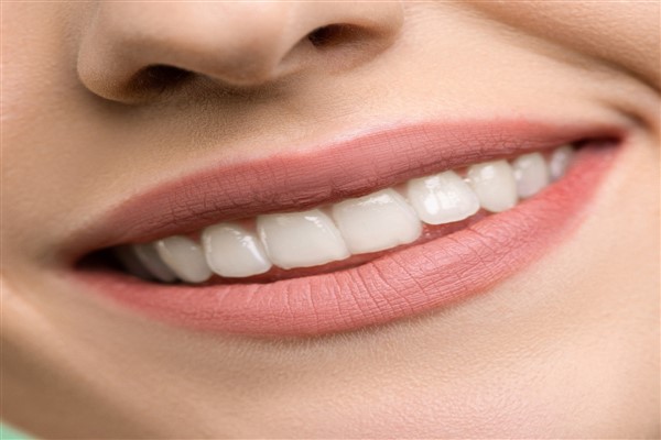 Daha beyaz ve orantılı dişler Hollywood gülüşü ile mümkün