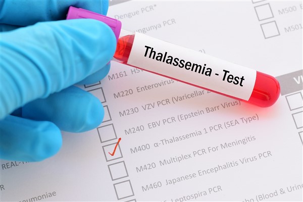 Talasemide enfeksiyona bağlı yaşam kayıplarına karşı önlem alınmalı